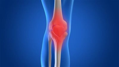 4 مشروبات لعلاج التهاب المفاصل