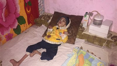 بالفيديو.. «محمد» يعاني ضمورا في المخ والتكفل بعلاجه أمل أسرته