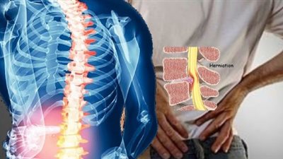 حبس شاب ينتحل صفة أخصائي لعلاج مرضى الغضروف بـ