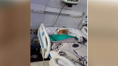 تفاصيل نجاح فريق طبي في إنقاذ حياة مريض  بمستشفى ميت غمر بالدقهلية