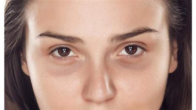 3 وصفات طبيعية غير مكلفة تخلصك من الهالات السوداء