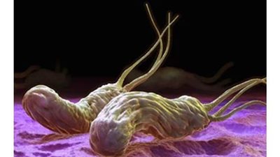 أعراض جرثومة المعدة