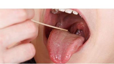 أعراض احتقان الحلق.. احذرها