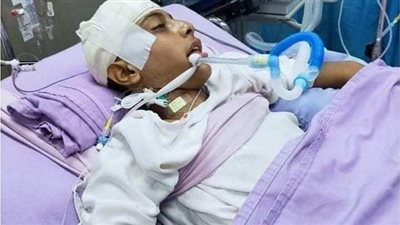 إصابة شابين في تصادم موتسكل بتوك توك على طريق المعري بقنا