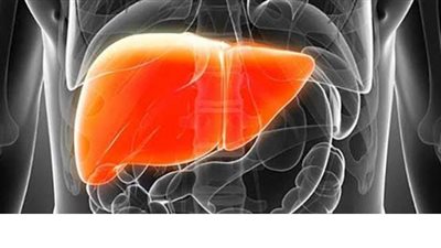 اعراض  تليف الكبد وطرق الكشف عنه