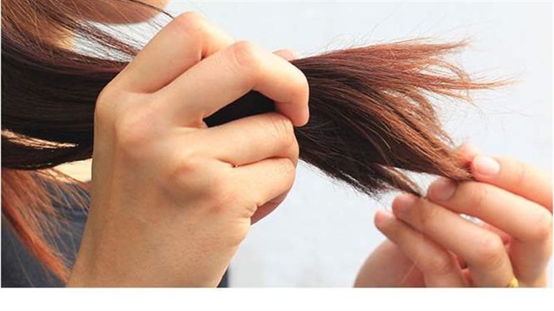 علاج تقصف الشعر