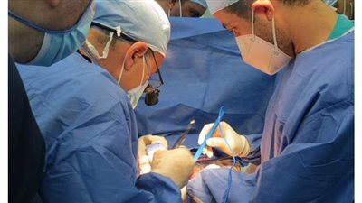 نجاح أول عملية استئصال للفص الأيسر من الكبد بوجود ورم دموي بمستشفى التضامن ببورسعيد