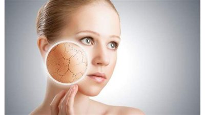 ٣ طرق لتجنب تشققات الجلد خلال الشتاء.. تعرفي عليها