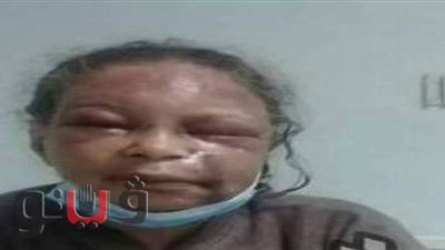 شاب يعتدي بالضرب على والدته العجوز بسبب زوجته في الغربية