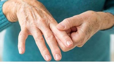 ما هو مرض الروماتويد؟.. تعرف على أهم الأعراض