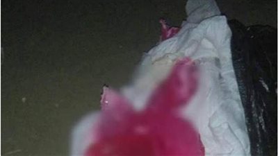 التحقيقات: مغسل موتى وراء رمي ساق بشرية في صندوق قمامة بالجيزة