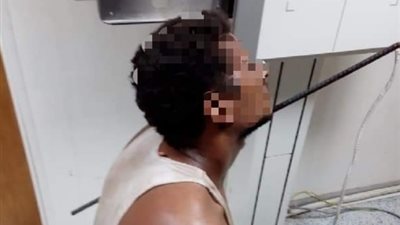 استخراج سيخ طوله 90 سم من كتف شاب بمستشفى الغردقة (صور)