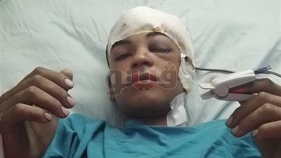 فريق طبي بمستشفى سوهاج ينجح في استخراج مفك اخترق مخ شاب (صور)