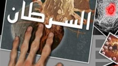 5 طرق ذهبية تحمي من الإصابة بالسرطانات الخبيثة