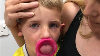 صبي يكاد يفقد لسانه بسبب فوهة زجاجة (صور)