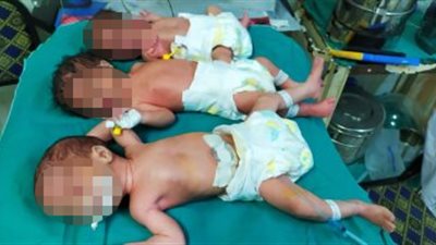 سيدة تنجب 3 توائم بالحقن المجهري في الشرقية بعد انتظار 10 أعوام