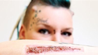 امرأة تقطع عقلة إصبعها لسبب غريب (صور)