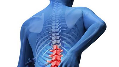 3 علامات تكشف إصابتك بأورام العظام