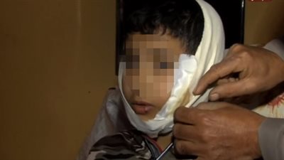 «أطفال بدرجة بلطجية».. يذبح زميله بـ«موس حلاقة».. تلميذ بالابتدائية يشوه وجه صديقه في خناقة بالمنيا.. و«20 غرزة» برقبة طفل بعد الاعتداء عليه بغرض السرقة في قنا