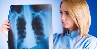 الغذاء والدواء الأمريكية توافق على أول علاج لمرضى سرطان الرئة