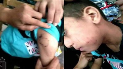 تفاصيل تعذيب طفل على يد زوجة ابيه في الدقهلية | فيديو وصور