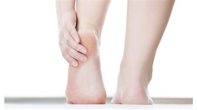 أفضل وأسرع علاج من الطبيعة لتشقق القدمين