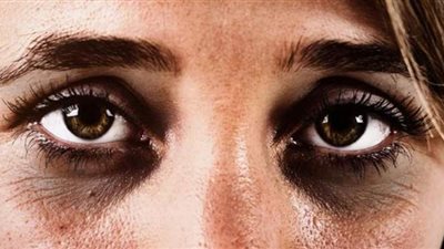 طرق طبيعية للتخلص من الهالات السوداء بشكل نهائي