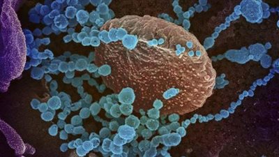 عالم روسي يحدد مستوى خطورة سلالة كورونا الجديدة