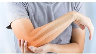 أسباب وأعراض نقص الكالسيوم فى الجسم