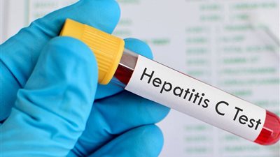 المتابعة الدورية سلاحك للقضاء على فيروس سي