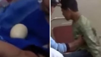 مراهق يضع بيضا من مؤخرته يتسبب في حيرة الأطباء (فيديو)