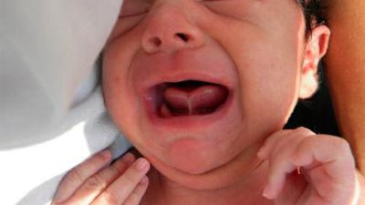 6 علامات تكشف إصابة طفلك باللسان المربوط