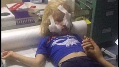 لقطات مفجعة لامرأة مسنة تطعن طفلا في وجهه (فيديو)