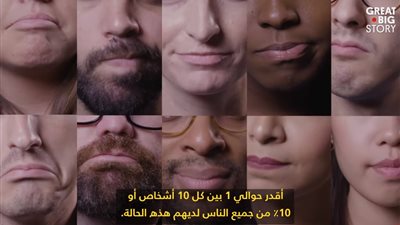 طبيب أمريكي يفسر ظاهرة العطس عند الخروج المفاجئ للشمس (فيديو)