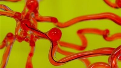 ابتكار روبوت على شكل خيط للمرور عبر شرايين المخ