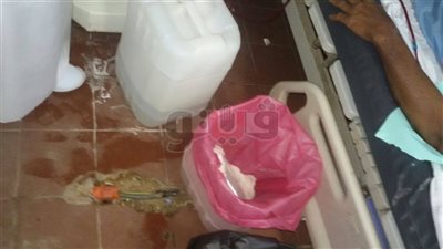 نشرة المحافظات.. عمليات غسيل لمرضى الكلى وسط مياه الصرف بمستشفى الأقصر