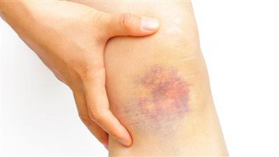 6 أسباب غريبة لإصابتك بالـ