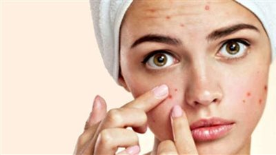 أقوى وأسرع ماسك يخلصك من حب الشباب وآثاره