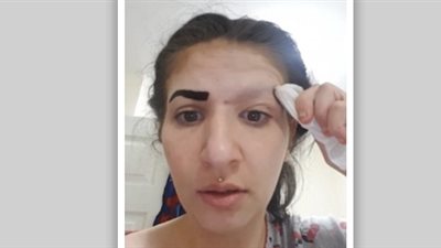 امرأة تشتري منتجا من الإنترنت فتخسر حاجبيها (فيديو وصور)