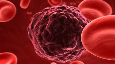 باحثون: يمكن وقف حركة الخلايا السرطانية والسيطرة عليها