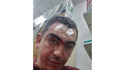 وزير القوى العاملة: حقوق الصيدلي الذي تعرض للضرب بالسعودية محفوظة