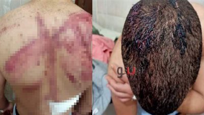 دخل حمام الكافيه من غير إذنه.. أردني وآخرون يمزقون جسد طالب بالسيوف في أكتوبر | فيديو