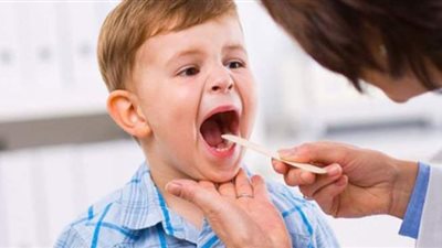علاج التهاب الحلق عند الأطفال