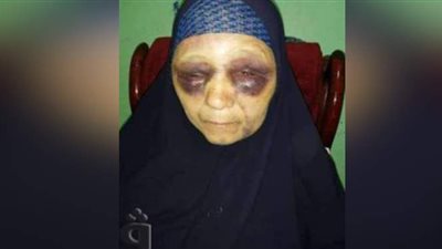 قلبي ولدي حجر.. محمد يضرب أمه طمعًا في معاشها بكفر الشيخ