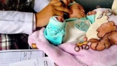 فحص 9084 طفل حديث الولادة بالمنيا ضمن مبادرة السمعيات