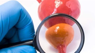 تعرف على أعراض التهاب البروستاتا وطرق العلاج