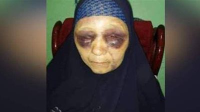 والدة الابن العاق: باع منزلي وحاول قتلي من أجل 200 جنيه