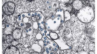 توقعات بالتصريح لاستخدام لقاح 