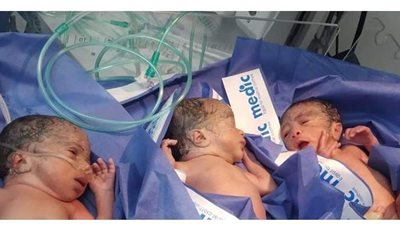 نجاح عملية ولادة 3 توائم بمستشفى إسنا التخصصى بجنوب الأقصر