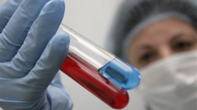 تفاصيل اكتشاف القومي للبحوث علاج جديد للسرطان